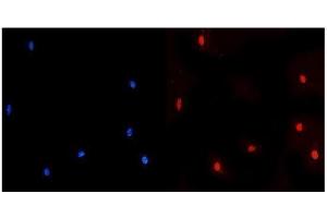 IF analysis of NUP214 using anti-NUP214 antibody (ABIN7601473). (NUP214 Antikörper  (AA 36-374))
