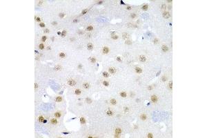 Immunohistochemistry of paraffin-embedded mouse brain using CDC27 antibody at dilution of 1:200 (40x lens). (CDC27 Antikörper)