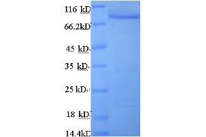 SDS-PAGE (SDS) image for Angiopoietin-Related Protein 4 (ANGL4) (AA 28-403), (partial) protein (GST tag) (ABIN5712720) (ANGL4 Protein (AA 28-403, partial) (GST tag))