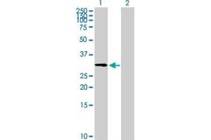 Western Blot analysis of ZNF511 expression in transfected 293T cell line by ZNF511 MaxPab polyclonal antibody. (ZNF511 Antikörper  (AA 1-252))