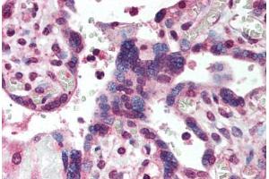 Human Placenta (formalin-fixed, paraffin-embedded) stained with SMAD2 antibody ABIN293877 at 5 ug/ml followed by biotinylated goat anti-rabbit IgG secondary antibody ABIN481713, alkaline phosphatase-streptavidin and chromogen. (SMAD2 Antikörper  (AA 234-249))