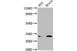 Western Blot Positive WB detected in: PC-3 whole cell lysate, Mouse brain tissue All lanes: HOXD8 antibody at 4. (HOXD8 Antikörper  (AA 59-108))