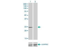 Western blot analysis of QDPR over-expressed 293 cell line, cotransfected with QDPR Validated Chimera RNAi (Lane 2) or non-transfected control (Lane 1).