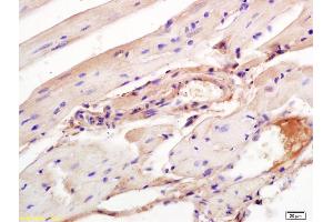 Formalin-fixed and paraffin embedded mouse heart labeled with Rabbit Anti Aggrecanase-2/ADAMTS5 Polyclonal Antibody, Unconjugated (ABIN701005) at 1:200 followed by conjugation to the secondary antibody and DAB staining (ADAMTS5 Antikörper  (AA 511-610))