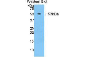 Western blot analysis of the recombinant protein. (ANGPTL3 Antikörper  (AA 237-455))