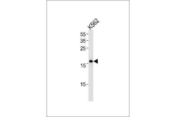 POLE3 Antikörper  (N-Term)