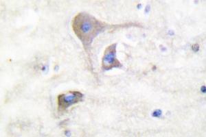Image no. 2 for anti-Synuclein, beta (SNCB) antibody (ABIN271836)