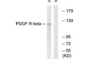 Western blot analysis of extracts from Jurkat cells, treated with TNF-a 20ng/ml 5', using PDGFR beta (Ab-740) Antibody. (PDGFRB Antikörper  (AA 711-760))