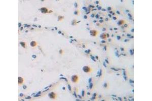 IHC-P analysis of Human Tissue, with DAB staining. (GADD45A Antikörper  (AA 1-165))