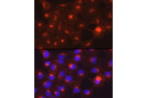 Immunofluorescence analysis of DU145 cells using Axl Rabbit pAb (ABIN7265804) at dilution of 1:200 (40x lens).