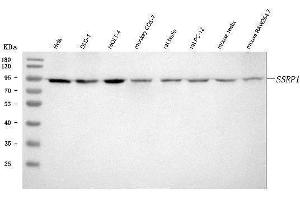 Western blot analysis of SSRP1 using anti-SSRP1 antibody (ABIN7600496).