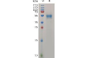 Human PRNP(90-230) Protein, hFc Tag on SDS-PAGE under reducing condition. (PRNP Protein (AA 90-230) (Fc Tag))