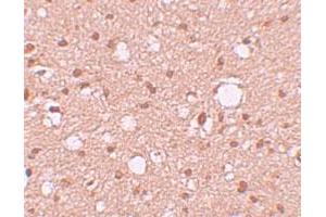 Immunohistochemical staining of human brain cells with APBA2 polyclonal antibody  at 10 ug/mL.