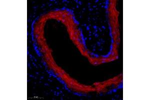 Immunofluorescence of paraffin embedded mouse esophagus using SPRR3 (ABIN7075637) at dilution of 1:2000 (300x lens) (SPRR3 Antikörper)