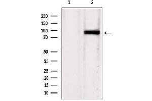 Western blot analysis of extracts from HepG2, using IFT88 antibody. (IFT88 Antikörper  (C-Term))