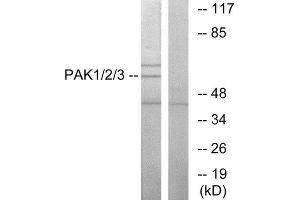 Western Blotting (WB) image for anti-P21-Activated Kinases 1/2/3 (PAK1/2/3) (Thr402), (Thr421), (Thr423) antibody (ABIN1847964) (PAK1/2/3 Antikörper  (Thr402, Thr421, Thr423))
