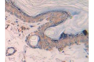 Used in DAB staining on fromalin fixed paraffin- embedded skeletal muscle tissue (CCL4 Antikörper  (AA 24-92))