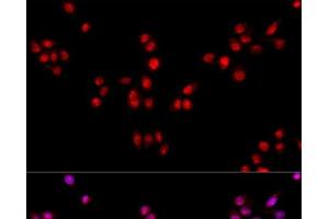 Immunofluorescence analysis of HeLa cells using ESRRA Polyclonal Antibody at dilution of 1:100. (ESRRA Antikörper)