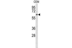 Western Blotting (WB) image for anti-EH-Domain Containing 3 (EHD3) antibody (ABIN3003227) (EHD3 Antikörper)