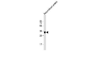 Anti-LRP1B Antibody at 1:2000 dilution + Recombinant protein Lysates/proteins at 20 μg per lane. (LRP1B Antikörper  (AA 2620-2891))