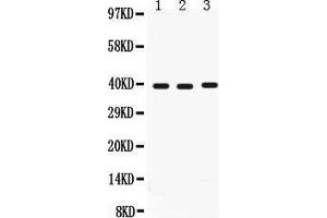Anti-Midkine antibody, Western blotting All lanes: Anti Midkine  at 0. (Midkine Antikörper  (AA 21-143))