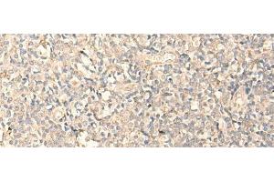 Immunohistochemistry of paraffin-embedded Human tonsil tissue using MPPED2 Polyclonal Antibody at dilution of 1:25(x200) (MPPED2 Antikörper)