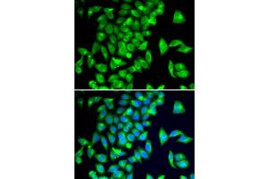 Immunofluorescence analysis of A549 cells using TPH2 antibody (ABIN5974298). (Tryptophan Hydroxylase 2 Antikörper)