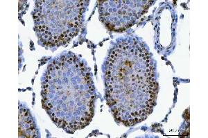 IHC analysis of SAP130 using anti-SAP130 antibody (ABIN7601247). (SAP130 Antikörper  (AA 309-913))