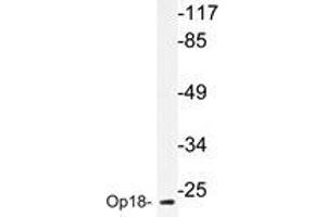 Western blot analyzes of Op18 antibody in extracts from COLO205 cells. (Stathmin 1 Antikörper)