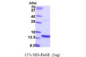 SDS-PAGE (SDS) image for Adipogenesis Associated Mth938 Domain Containing (AAMDC) (AA 1-122) protein (His tag) (ABIN5853948)