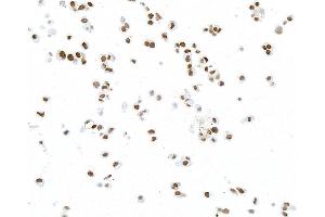 Immunocytochemistry (ICC) image for anti-Paired Box 8 (PAX8) antibody (ABIN7795602) (PAX8 Antikörper)