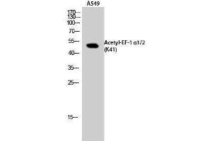 Western Blotting (WB) image for anti-Eukaryotic Translation Elongation Factor 1 Alpha1/Alpha2 (EF-1 Alpha1/2) (acLys41) antibody (ABIN3180430) (EF-1 Alpha1/2 Antikörper  (acLys41))