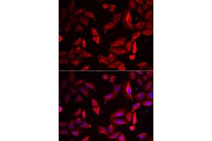 Immunofluorescence analysis of HeLa cells using SERPINB9 antibody. (SERPINB9 Antikörper)