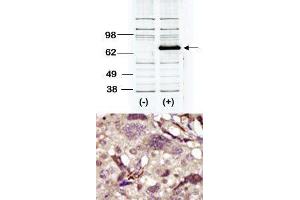 Image no. 2 for anti-Bruton Agammaglobulinemia tyrosine Kinase (BTK) (Middle Region) antibody (ABIN359974) (BTK Antikörper  (Middle Region))