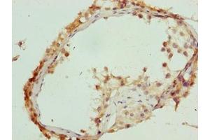 Immunohistochemistry of paraffin-embedded human testis tissue using ABIN7174755 at dilution of 1:100 (C17orf64 Antikörper  (AA 111-236))
