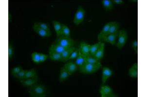 Immunofluorescence (IF) image for anti-Muskelin 1, Intracellular Mediator Containing Kelch Motifs (MKLN1) (AA 488-614) antibody (ABIN7160369)