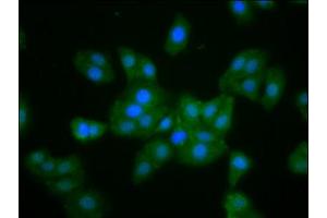 Immunofluorescence staining of HepG2 cells with ABIN7160369 at 1:133, counter-stained with DAPI. (MKLN1 Antikörper  (AA 488-614))