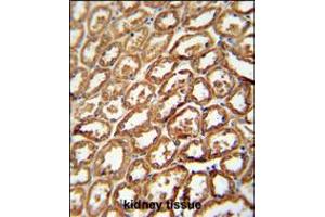 DEGS2 antibody immunohistochemistry analysis in formalin fixed and paraffin embedded human kidney tissue followed by peroxidase conjugation of the secondary antibody and DAB staining. (DEGS2 Antikörper  (C-Term))