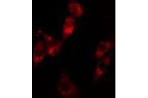ABIN6279766 staining Hela cells by IF/ICC. (ARHGAP12 Antikörper  (Internal Region))