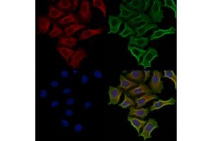 ABIN6257930 and ABIN6274821 staining Hela cells by IF/ICC. (AGXT2L2 Antikörper  (C-Term))