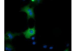 Anti-QPRT mouse monoclonal antibody (ABIN2453570) immunofluorescent staining of COS7 cells transiently transfected by pCMV6-ENTRY QPRT (RC202960). (QPRT Antikörper)