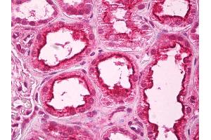 Anti-PPP1R10 antibody IHC of human kidney.