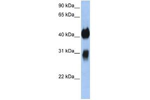 WB Suggested Anti-OTX1 Antibody Titration:  0. (OTX1 Antikörper  (C-Term))