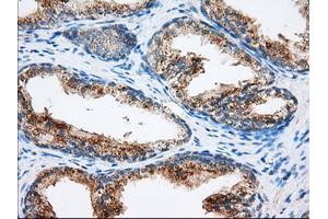 Immunohistochemical staining of paraffin-embedded liver tissue using anti-MTRF1L mouse monoclonal antibody.