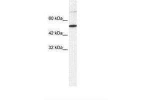 Image no. 1 for anti-T-Box 3 (TBX3) (AA 404-453) antibody (ABIN203221) (TBX3 Antikörper  (AA 404-453))