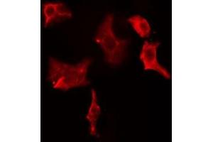 ABIN6274964 staining HeLa cells by IF/ICC. (CBR1 Antikörper  (C-Term))