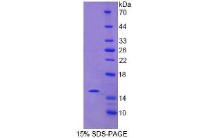 SDS-PAGE (SDS) image for Natural Cytotoxicity Triggering Receptor 2 (NCR2) (AA 22-120) protein (His tag) (ABIN4988883) (NKp44/NCR2 Protein (AA 22-120) (His tag))