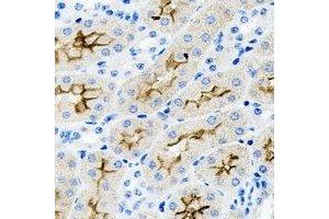 Immunohistochemical analysis of PAR6A staining in rat kidney formalin fixed paraffin embedded tissue section. (PARD6A Antikörper)