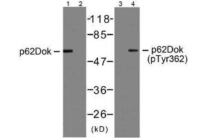Western blot analysis of extracts from Jurkat cells, using p62Dok (Ab-362) antibody (E021268, Line 1 and 2) and p62Dok (phospho-Tyr362) antibody (E011276, Line 3 and 4). (DOK1 Antikörper  (pTyr362))