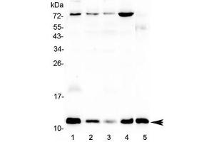 Western blot testing of human 1) U-87 MG, 2) MCF7, 3) A549, 4) HepG2 and 5) mouse testis lysate with DYNLT1 antibody at 0.